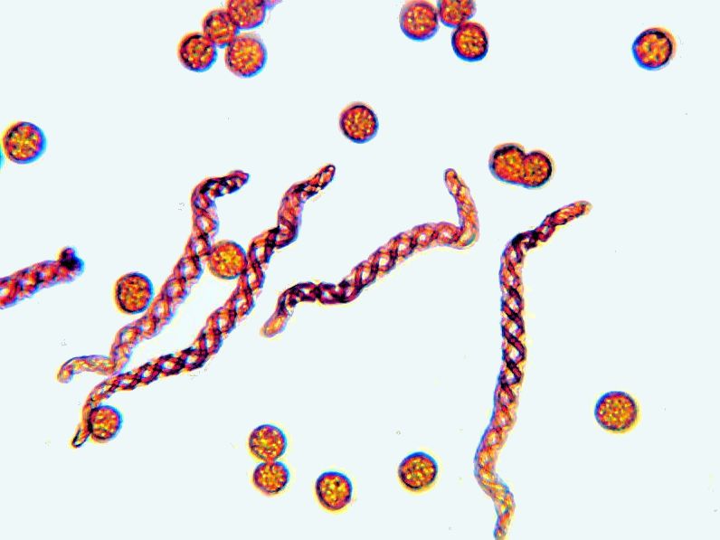 Chiloscyphus profundus